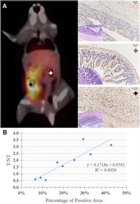 Nivolumab-DTPA-Based PD-1 Imaging Reveals Structural and Pathological Changes in Colorectal Carcinoma